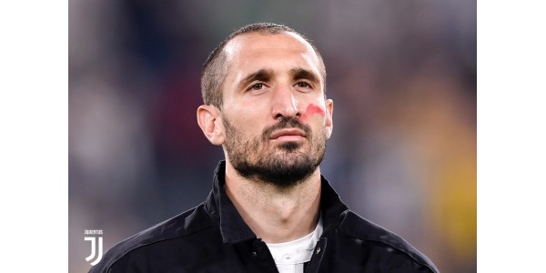 Chiellini voller Akt ist ausgesetzt